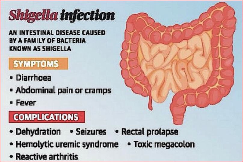 CDC Sounds the Alarm as Drug-Resistant Shigella Cases Surge Across America – What Every Family Needs to Know to Stay Protected